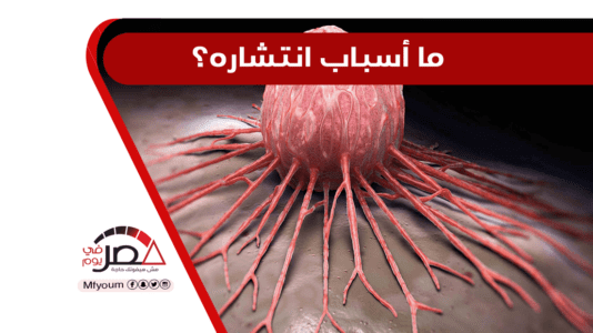 في يومه العالمي.. أرقام مرعبة عن مرض السرطان في مصر