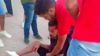 عمرو زكي لاعب الزمالك يتعرض لحادث مروع.. تفاصيل وصور