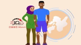 مرض البهاق.. ماذا تعرف عنه؟ (إنفوجراف)